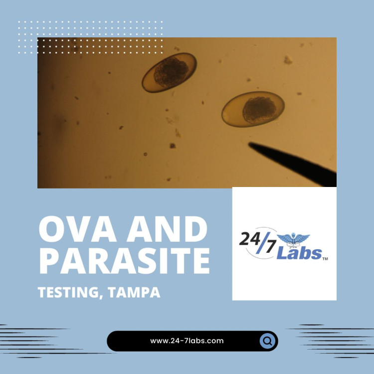 Your Natural Health begins when you have a healthy digestive system. That is why 24-7 Labs offers ova and parasite test in Tampa to detect the presence of parasites in your stool sample. We offer this test at an affordable price and we make it easy for you to book an appointment. Visit our website now!

https://www.24-7labs.com/product/parasite-examination-op/
